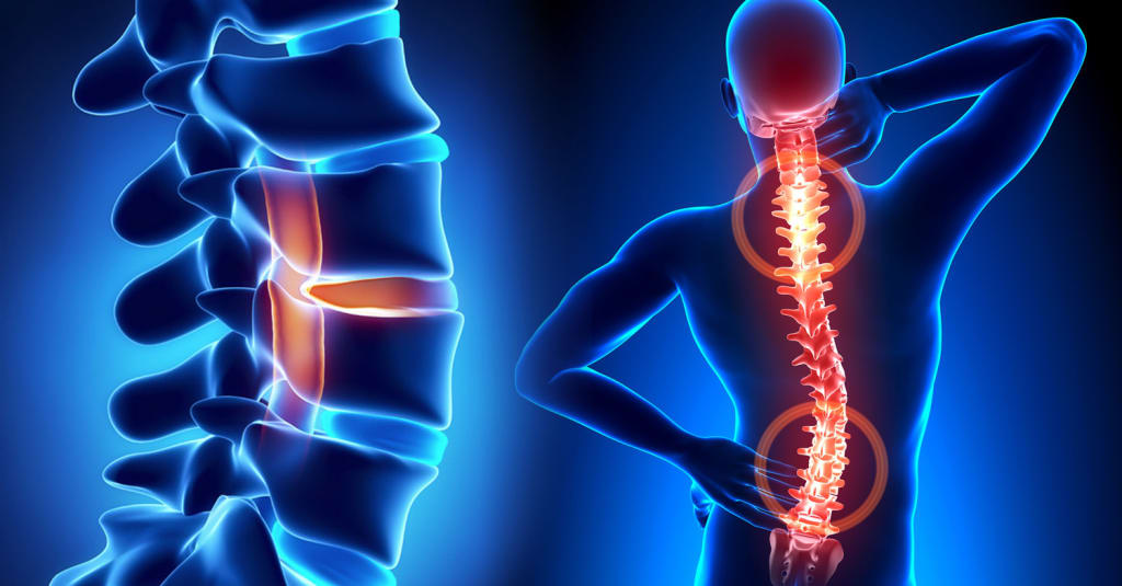 Spinal Pain Pain Management Fellowsip In India
