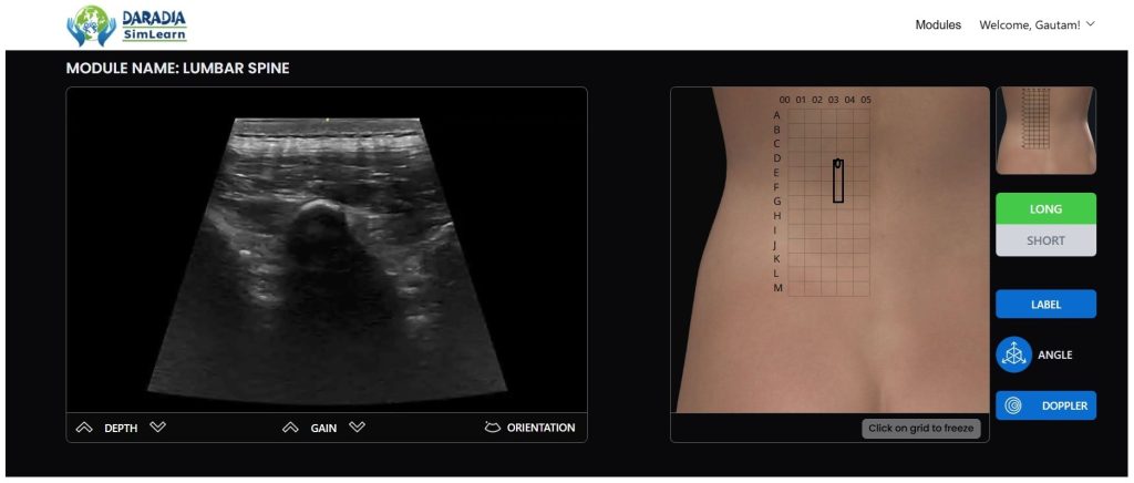 ultrasound simulator