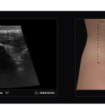 ultrasound simulator