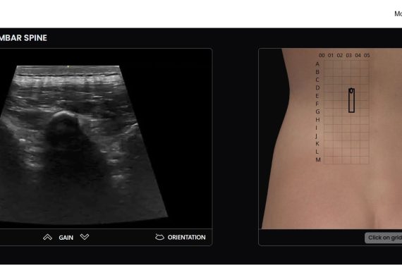 ultrasound simulator
